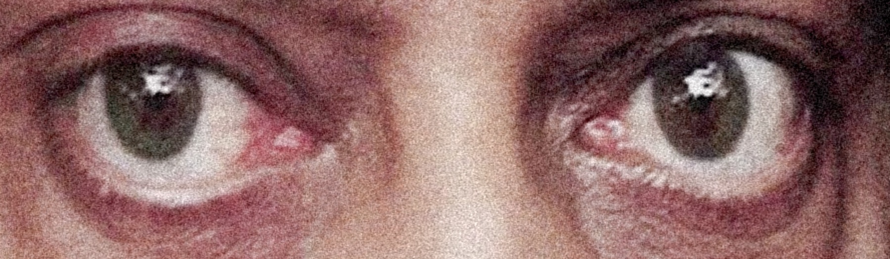 Eyes